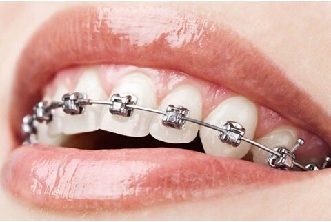 orthodontist Orangeville