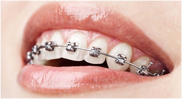 orthodontist Orangeville